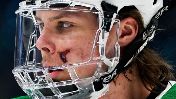 Closeup of Miro Heiskanen’s injured face